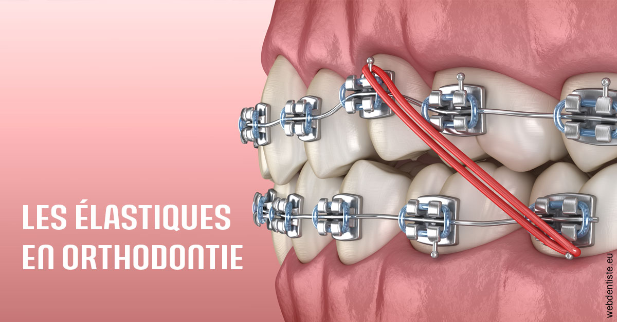 https://selarl-orthodontie-docteur-cuinet.chirurgiens-dentistes.fr/Elastiques orthodontie 2